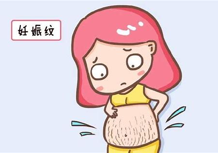 产后妊娠纹怎么淡化去除 妊娠纹的护理措施有哪些