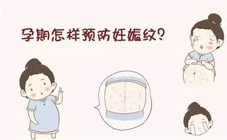 产后妊娠纹怎么淡化去除 妊娠纹的护理措施有哪些.jpg