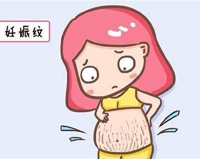 孕期里妊娠纹是如何形成的 妊娠纹如何预防和消除.jpg