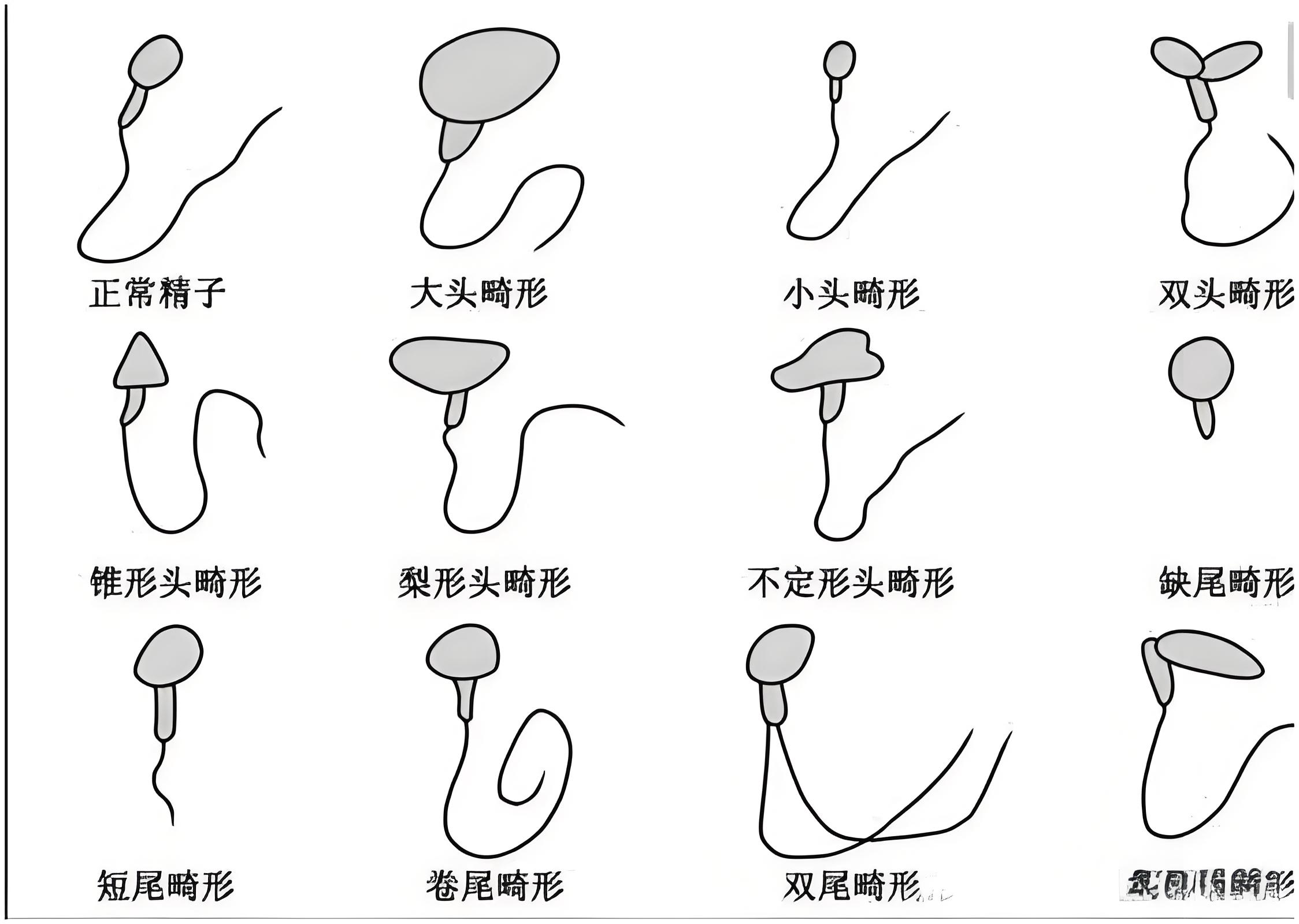 最新生殖健康警示：畸形精子率高达97%，正常精子仅占3%引发关注